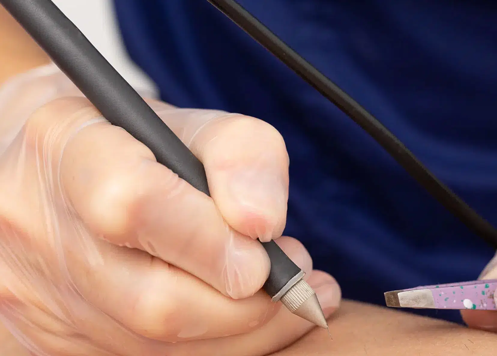 epilation electrique